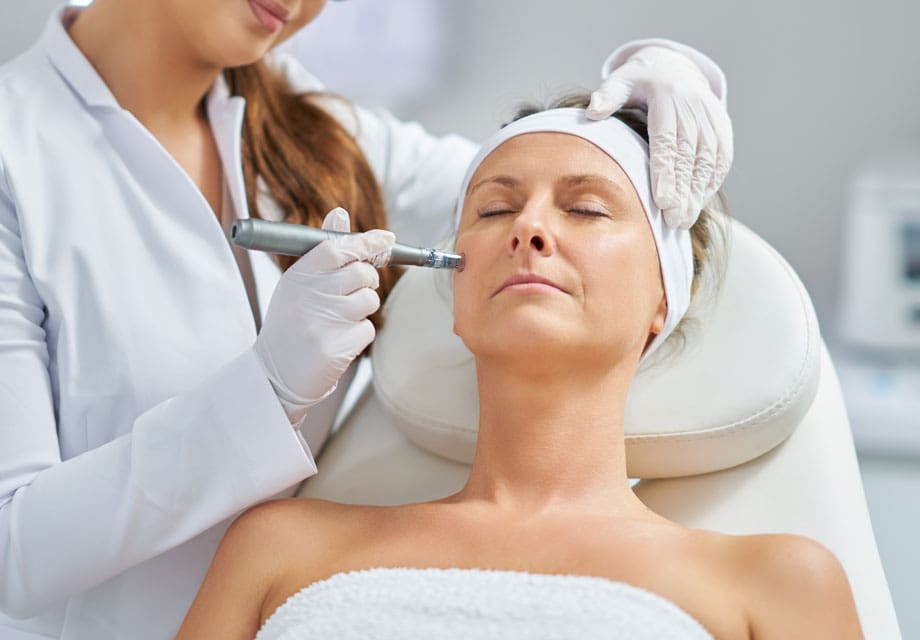 Microneedling Rochdale